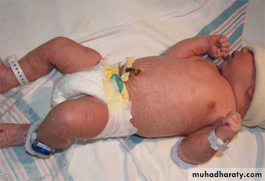 neonatal exam