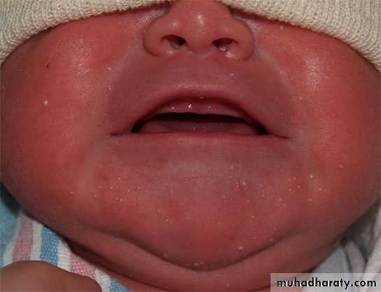 neonatal exam