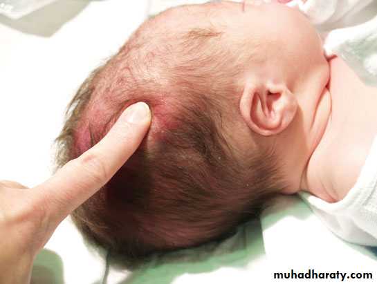 neonatal exam