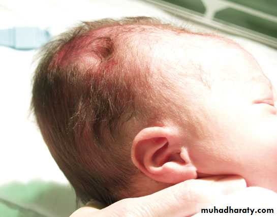 neonatal exam