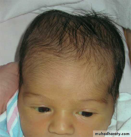 neonatal exam