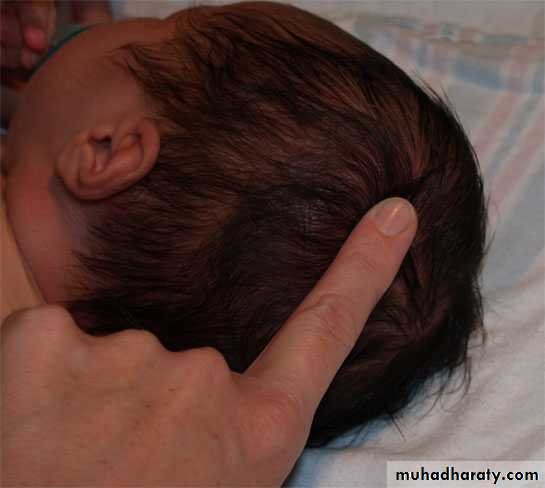 neonatal exam