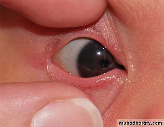 neonatal exam