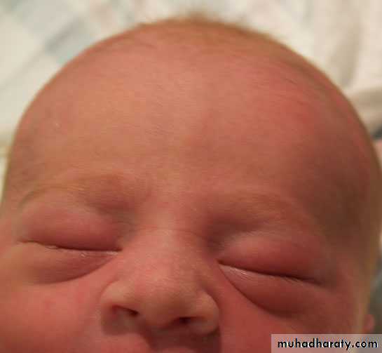 neonatal exam