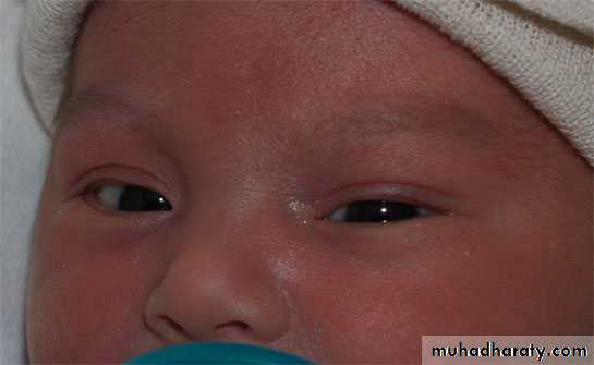 neonatal exam