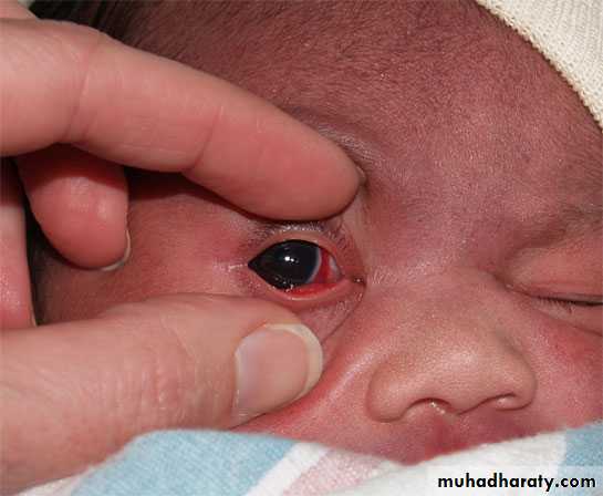 neonatal exam