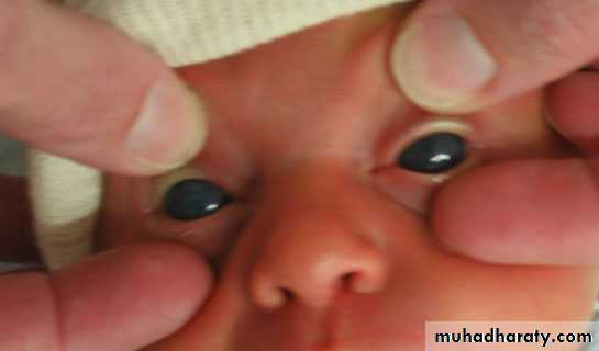 neonatal exam