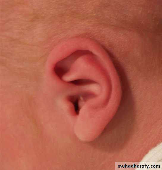 neonatal exam
