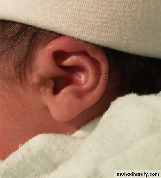 neonatal exam