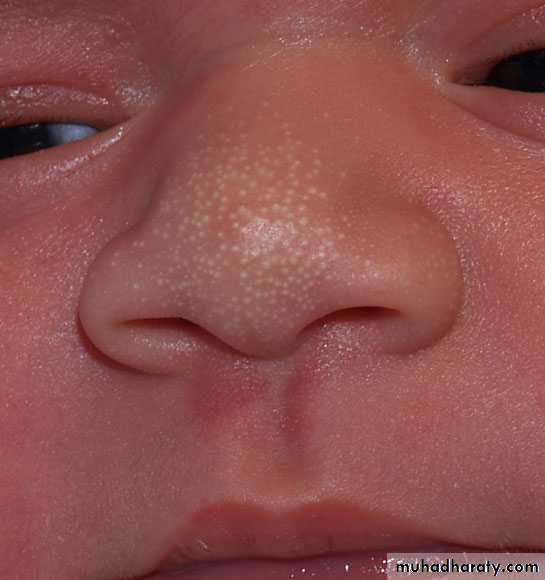 neonatal exam