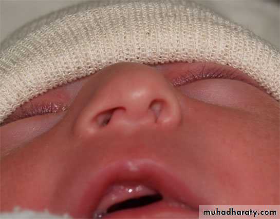 neonatal exam
