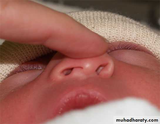 neonatal exam