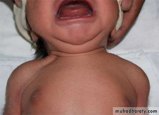 neonatal exam