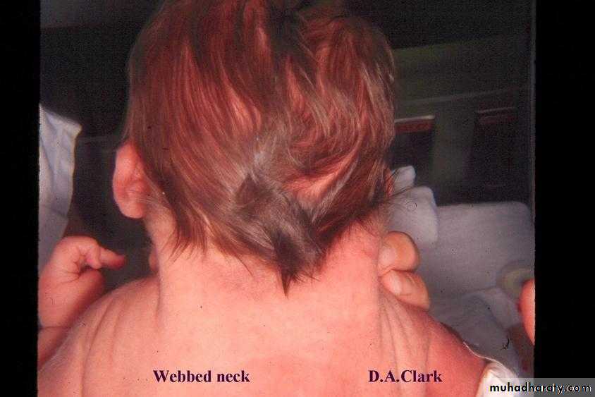 neonatal exam