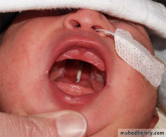 neonatal exam