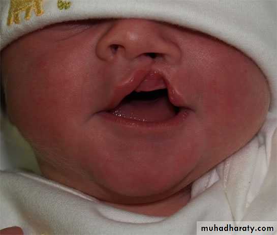 neonatal exam