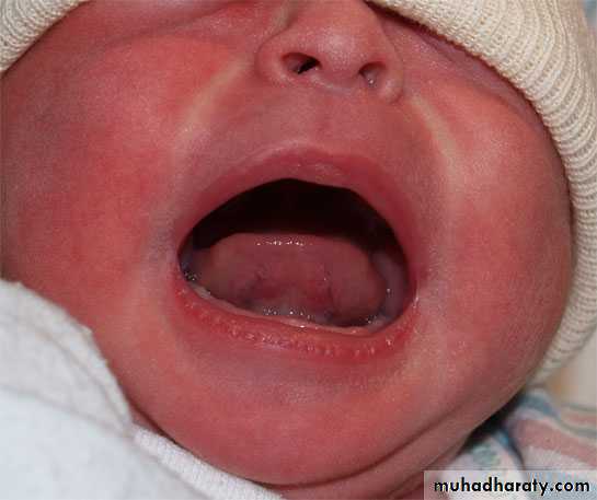 neonatal exam