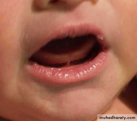 neonatal exam