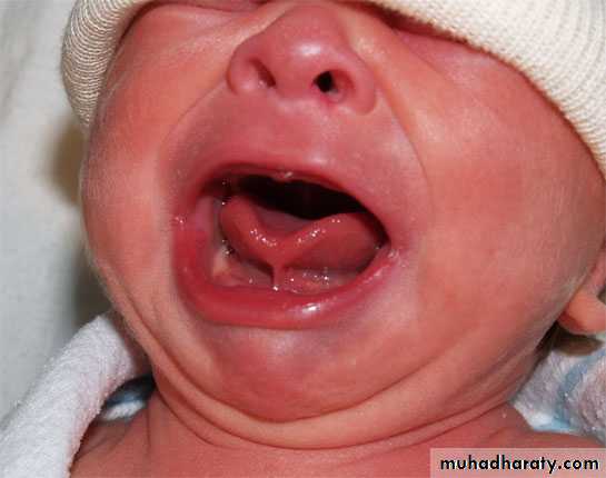 neonatal exam