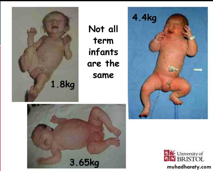 neonatal exam