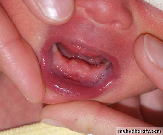 neonatal exam