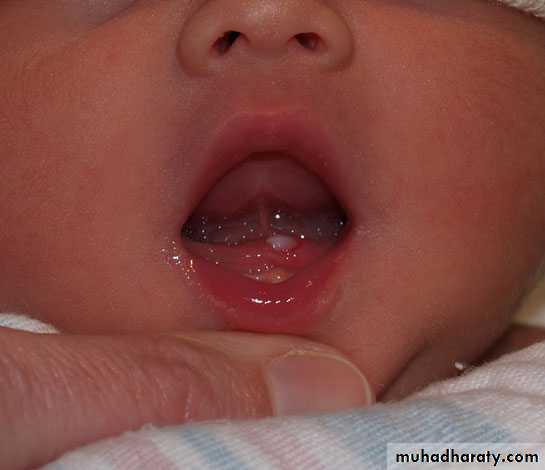 neonatal exam