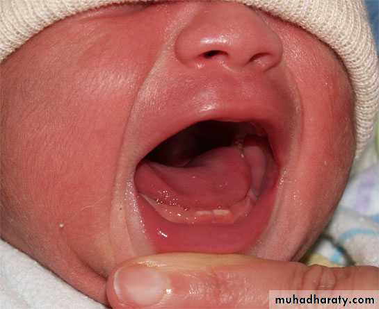 neonatal exam