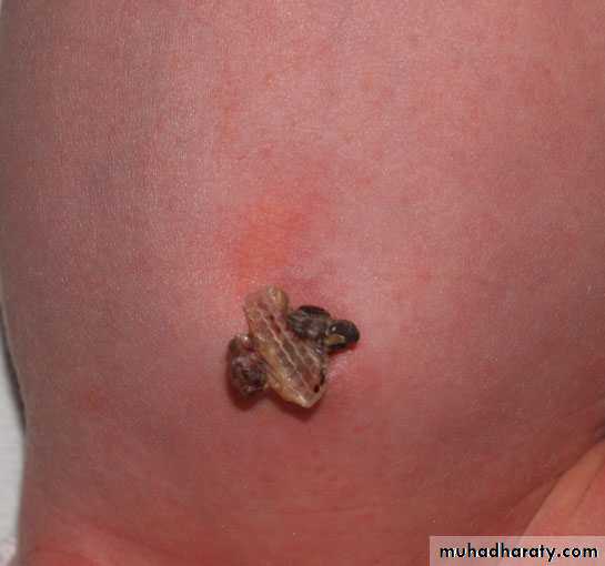 neonatal exam