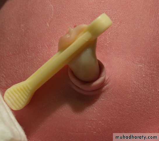 neonatal exam