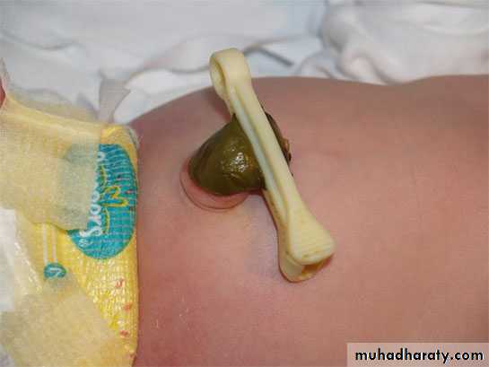 neonatal exam