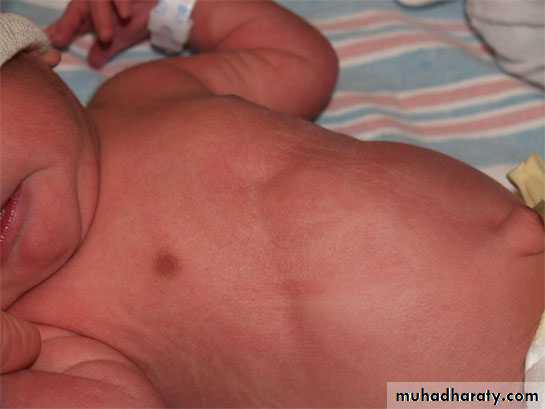 neonatal exam