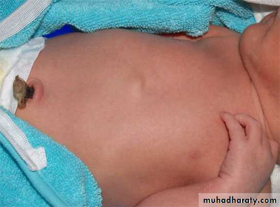 neonatal exam