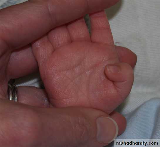 neonatal exam