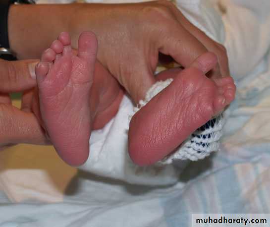 neonatal exam