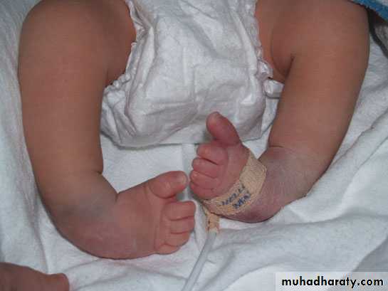 neonatal exam