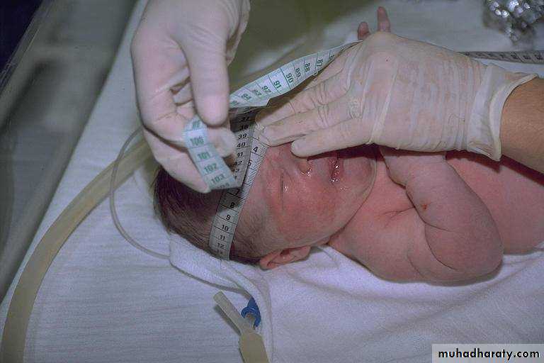 neonatal exam
