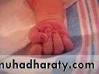 neonatal exam