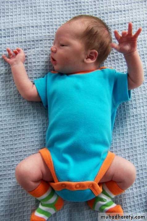 neonatal exam