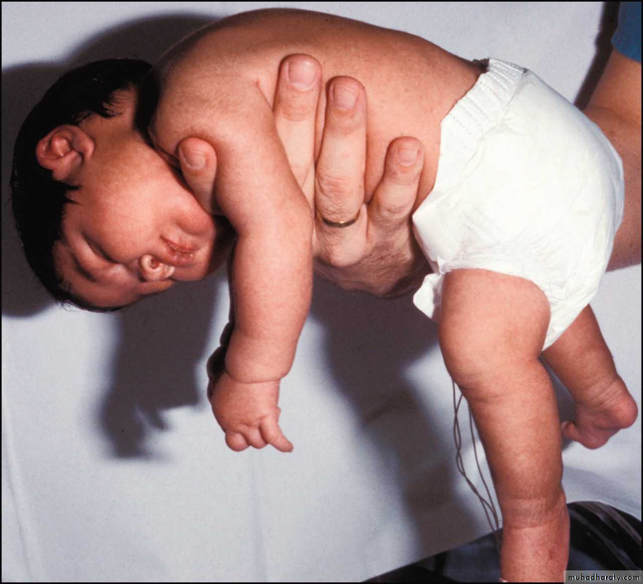 neonatal exam