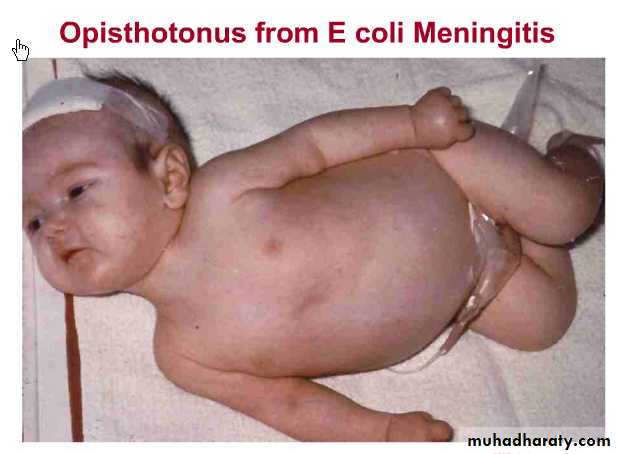 neonatal exam
