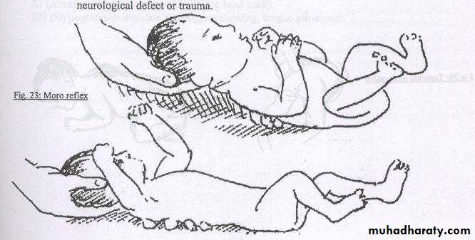 neonatal exam