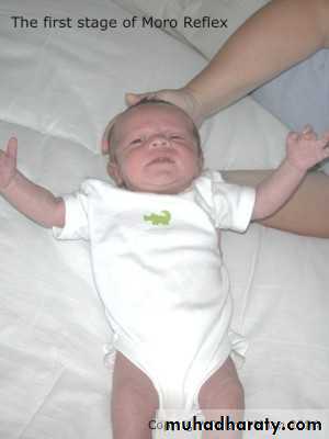 neonatal exam