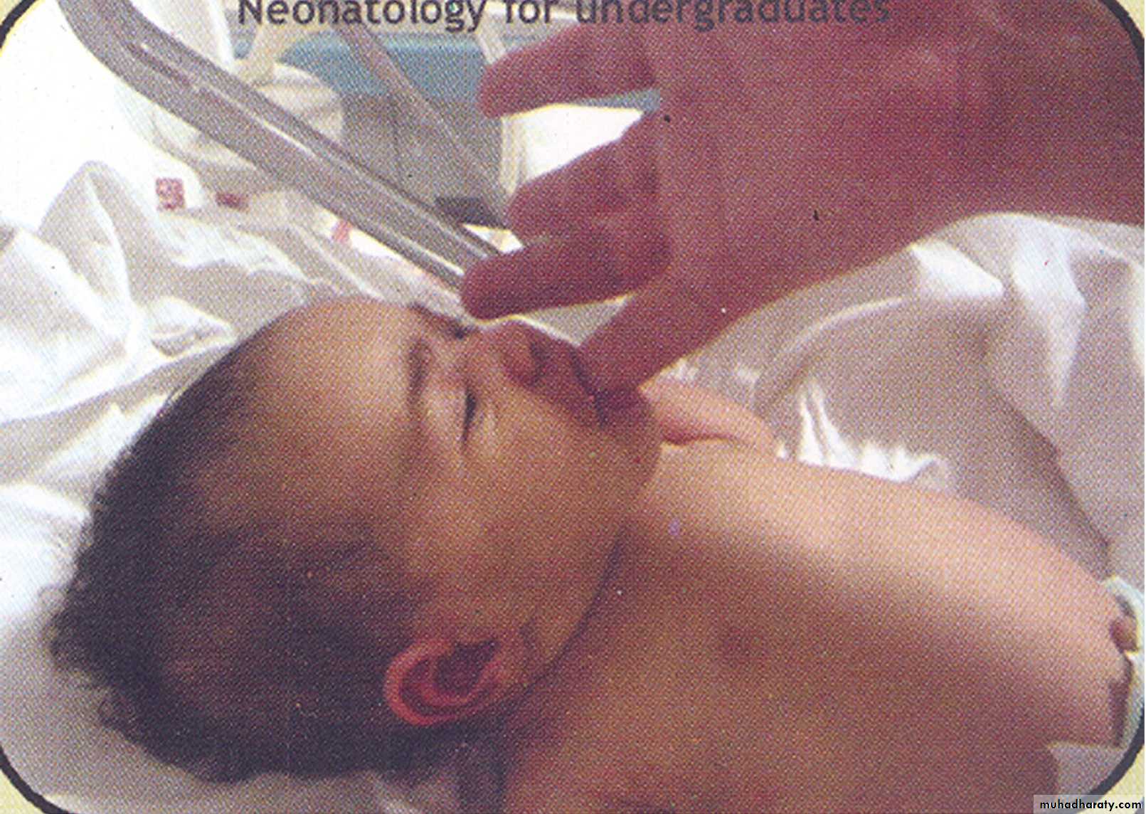 neonatal exam