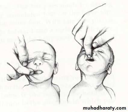 neonatal exam