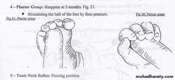 neonatal exam