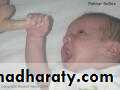 neonatal exam