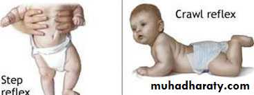 neonatal exam