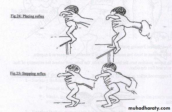 neonatal exam