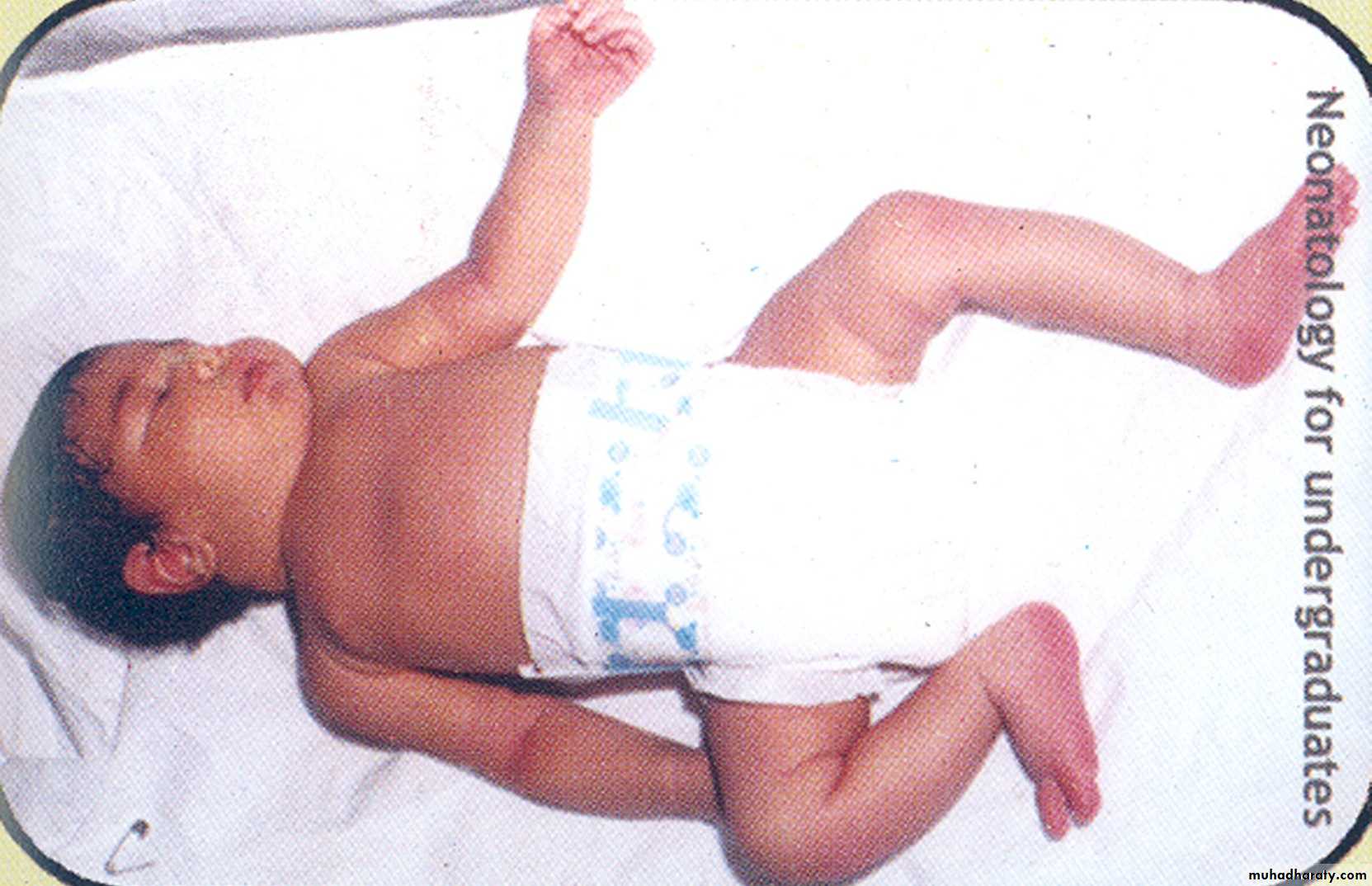 neonatal exam