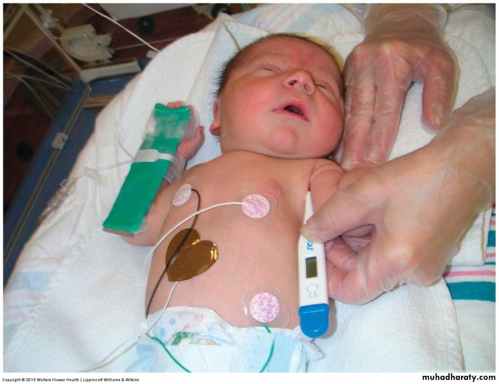 neonatal exam